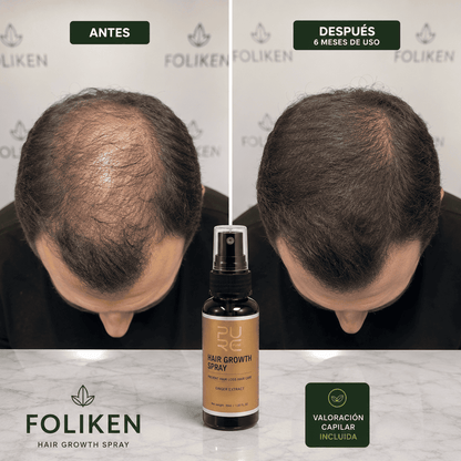 Purc Hair Growth Spray — Activa el Crecimiento Natural